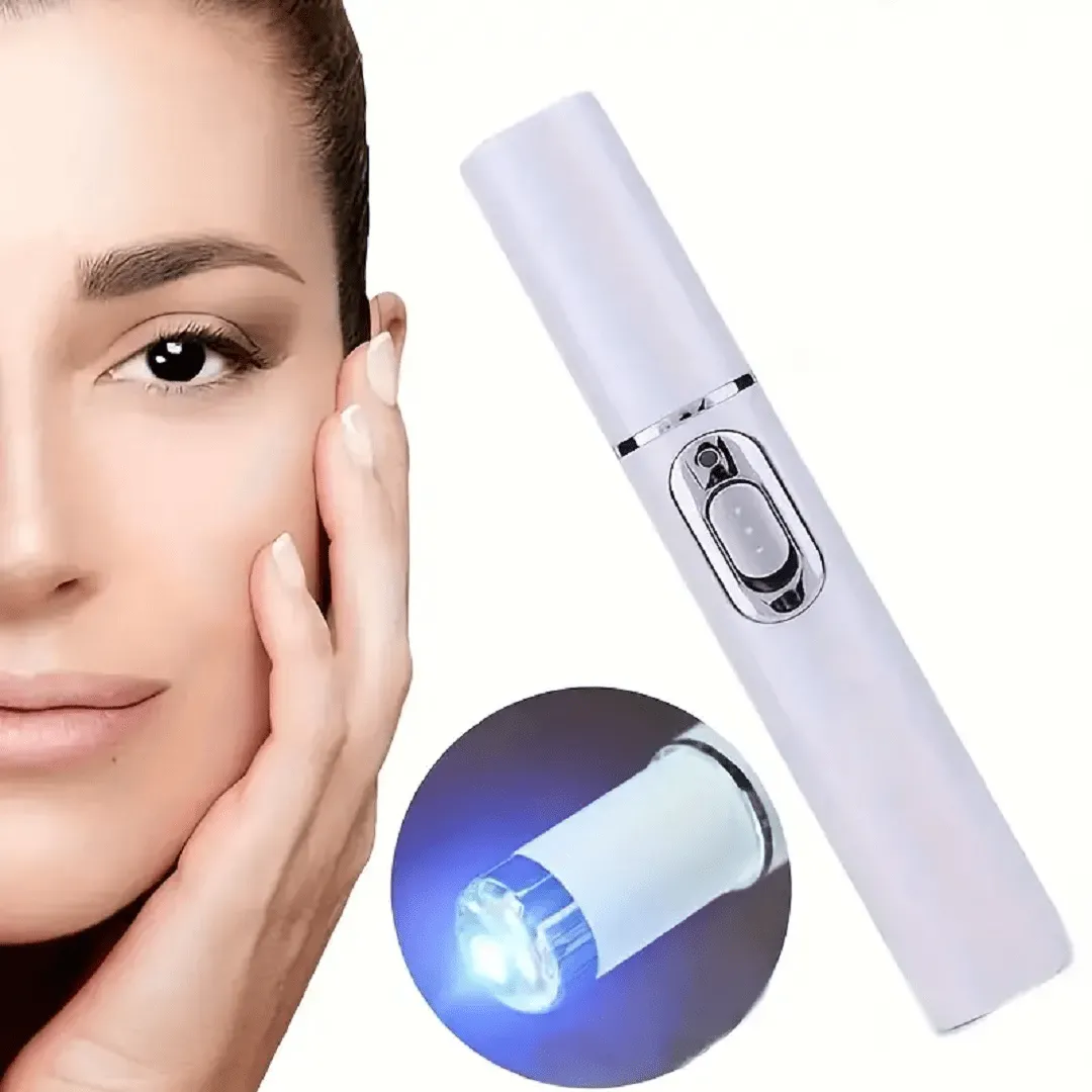 D'acné Laser Stylo De Ride et Cicatrice, Machine De Thérapie De Lumière Bleu